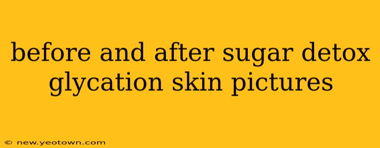 before and after sugar detox glycation skin pictures