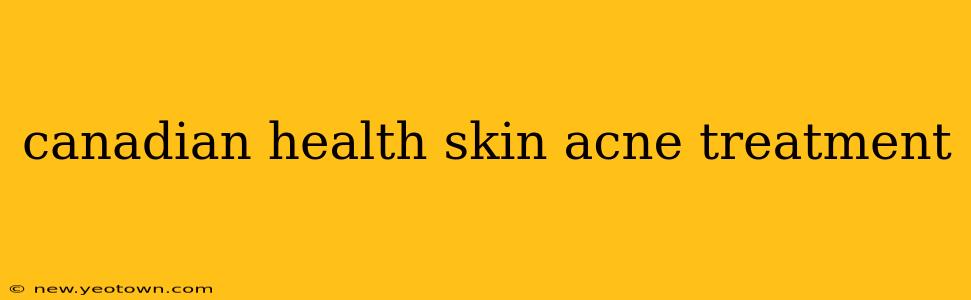 canadian health skin acne treatment