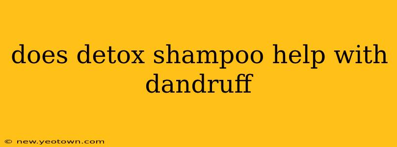 does detox shampoo help with dandruff