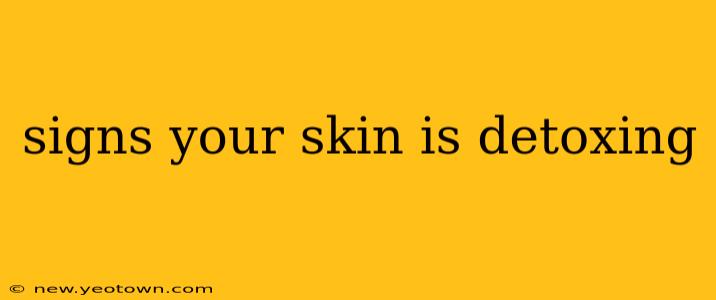 signs your skin is detoxing